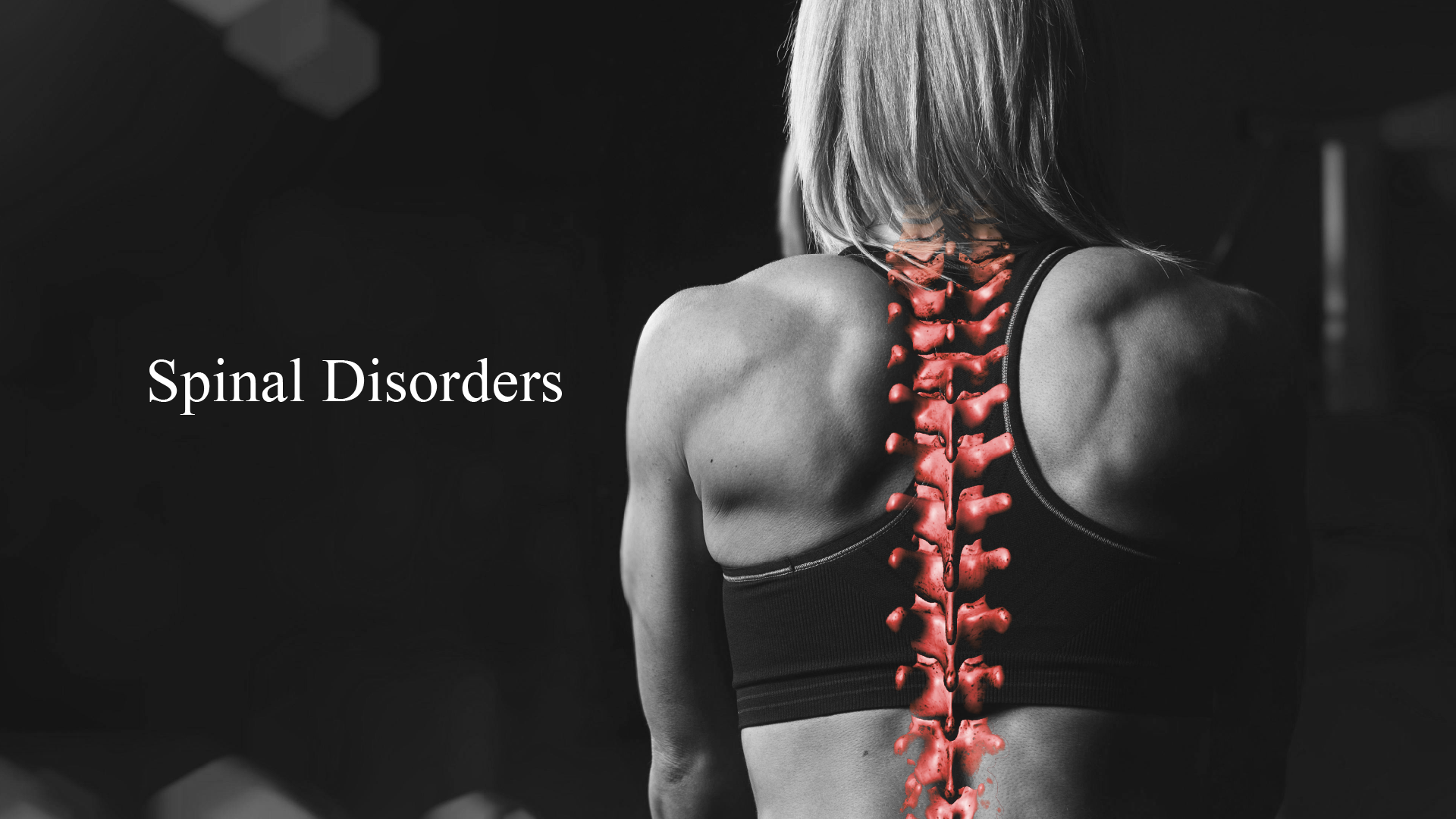 Comprehensive Overview of Spinal Pathology: Understanding Disorders, Diagnosis, and Treatment Options